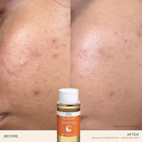 REN Ready Steady Glow Daily Aha Tonic 250ml Tonic & Lotion - thumbnail