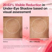 Anua Niacinamide 5 + TXA Brightening Pad 210 ml - thumbnail