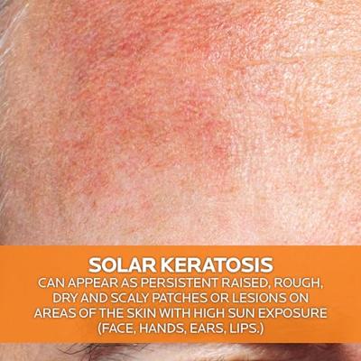 La Roche-Posay Anthelios 100KA + Med Crème 50gr