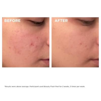 Clarins Exfoliators Beauty Flash Peel Peeling 50ml