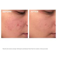 Clarins Exfoliators Beauty Flash Peel Peeling 50ml - thumbnail