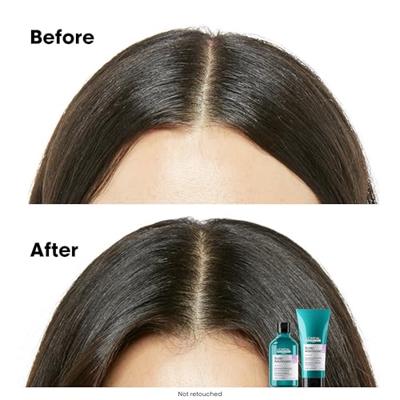 L'Oréal Professionnel - L'Oreal Serie Expert Scalp Advanced Set 500 ml Cadeauset Dames