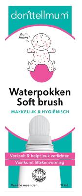 Donttellmum Waterpokken Behandeling