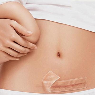 Organische siliconen gel litteken therapie patch worden gewassen en hergebruikt