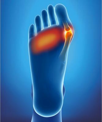 Epitact Kussentjes Met Dubbele Bescherming Maat 36-38 Epitact Kussentjes Met Dubbele Bescherming Maat 36-38