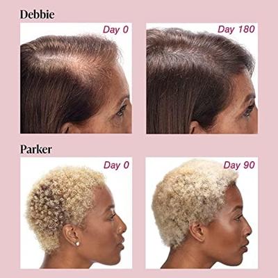 Viviscal Maximum Strength Hair Growth Supplement