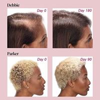 Viviscal Hair Growth Tablets Women - thumbnail