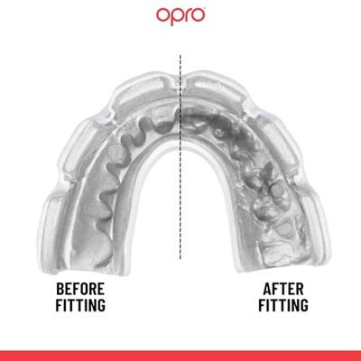 Opro 790001 Instant Custom Dentist Fit Mouthguard Braces - No colour - SR Opro 790001 Instant Custom Dentist Fit Mouthguard Braces - No colour - SR