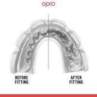 Opro 790001 Instant Custom Dentist Fit Mouthguard Braces - No colour - SR - thumbnail
