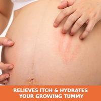 Palmers Cocoa Soothing Oil For Dry Itchy Skin - thumbnail