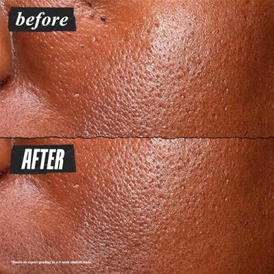 Kiehls - Kiehl's Ultra Pure High-Potency Serum 30 ml Kiehls - Kiehl's Ultra Pure High-Potency Serum 30 ml