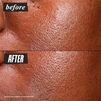 Kiehls - Kiehl&apos;s Ultra Pure High-Potency Serum 30 ml - thumbnail