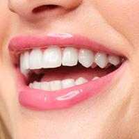 Artdeco Plumping Lip Fluid 3 ml Lipgloss - thumbnail