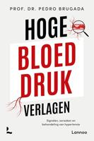 Hoe bloeddruk verlagen - thumbnail
