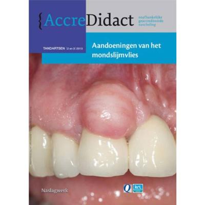 Aandoeningen van het mondslijmvlies (Paperback)