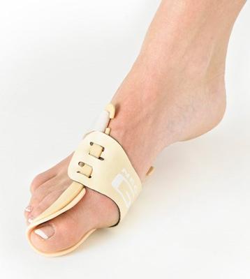 Hallux valgus splint - links