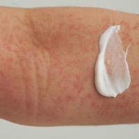 Extroderm skin balm bio 200 Milliliter - thumbnail