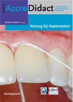 Nazorg bij implantaten (Paperback) - thumbnail