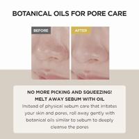 Skin1004 Madagascar Centella Light Cleansing Oil 30 ml - thumbnail