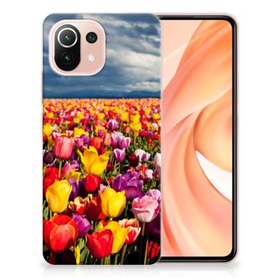 Xiaomi Mi 11 Lite | 11 Lite 5G NE | TPU Case | Tulpen