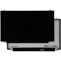 15.6 Inch LCD Scherm 1920x1080 Mat 40Pin - thumbnail