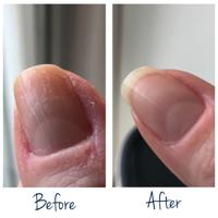 Herome Exit Damaged Nails - thumbnail