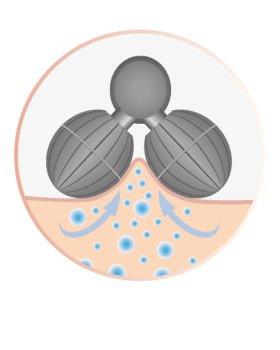 Trisa Electronics 1612.4700 Universeel Roestvrijstaal stimulator Trisa Electronics 1612.4700 Universeel Roestvrijstaal stimulator