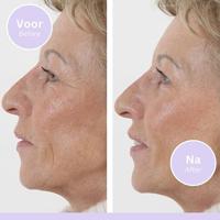 Orange Care Wrinkle Filler Serum - thumbnail