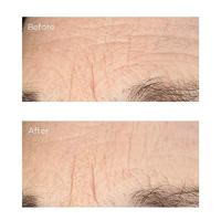 Perricone MD Deep Crease Serum - thumbnail