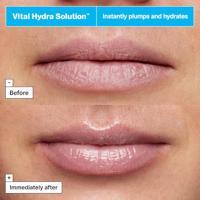 Dr. Jart+ Vital Hydra Solution Hydrating Lip Mask 20 ml - thumbnail