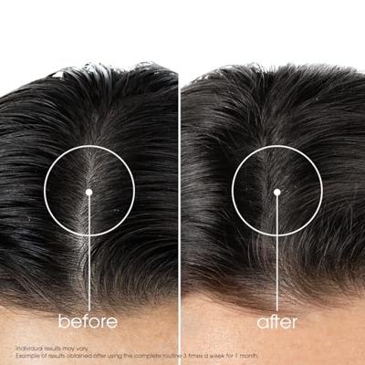 Klorane Shampoo Kinine & Edelweiss 400ml