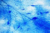 Bresser Microscoop preparaten 25 stuks : Biologie - thumbnail