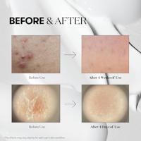 VT Cosmetic Reedle Shot 700 30 ml - thumbnail