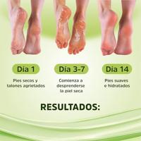 Voetscrub Luxiderma Sokken 2 Onderdelen - thumbnail