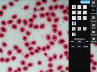 Kern OBE 134T241 OBE134T241 Digitale microscoop Trinoculair 100 x - thumbnail