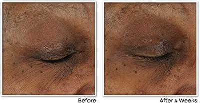 RoC Multi Correxion® Revive + Glow Daily Serum RoC Multi Correxion® Revive + Glow Daily Serum