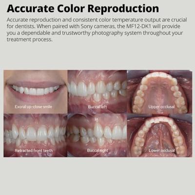 Godox MF12-DK1 Dental Flash Kit