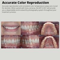 Godox MF12-DK1 Dental Flash Kit - thumbnail