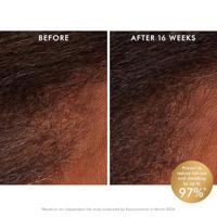 Moroccanoil Revitalizing Scalp Tonic 100ml - thumbnail