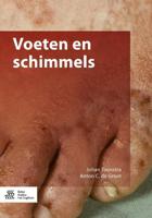 Voeten en schimmels (Paperback) - thumbnail