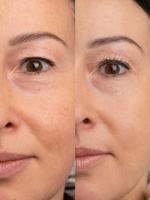 Sweed Beauty Pro EyeLash Serum 3ml - thumbnail