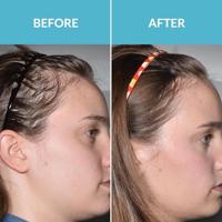 Talika Hair Force Serum 50ml - thumbnail