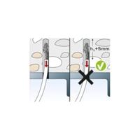 fischer plafondanker - FDN II 6/5 - 6x40 mm - thumbnail