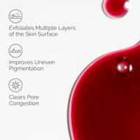 Gezicht Exfoliator The Ordinary AHA 30% + BHA 2% 30 ml - thumbnail