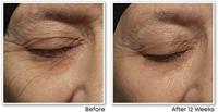 RoC Retinol Correxion Wrinkle Correct Night Cream 30ml - thumbnail