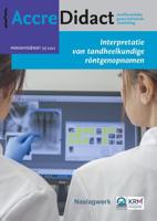 Interpretatie van tandheelkundige röntgenopnamen (Paperback) - thumbnail