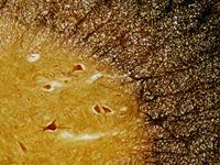BRESSER Microscoop preparaten 30 stuks - Histologie - thumbnail