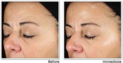 Roc Multi Correx.revive+glow Daily Serum Fl 30ml