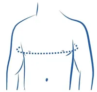 GO Medical Bovenrug Rugrechthouder - 1 - Zwart - thumbnail