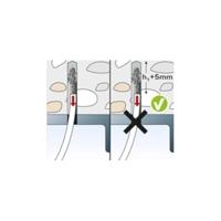 Fischer Deckennagel FDN II 6/35 545637 Plafondanker 100 stuk(s) - thumbnail